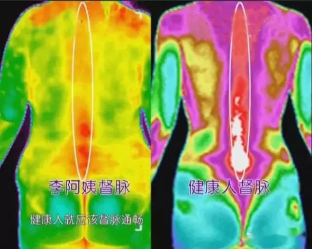 紅外熱成像可以看??？了解一下醫(yī)療診斷應(yīng)用